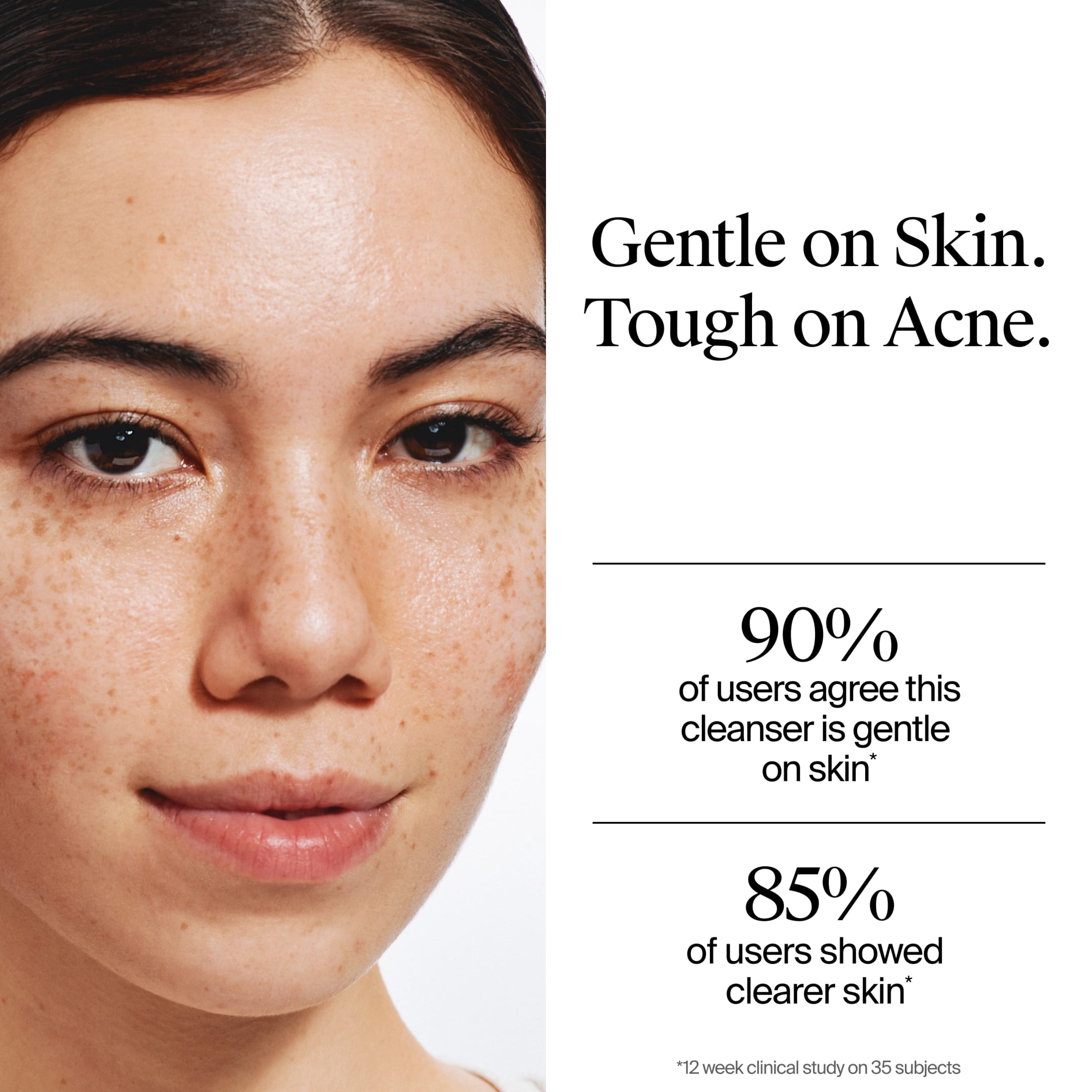 Neutrogena Oil-Free Acne Face Wash, Fragrance Free, 2% Salicylic Acid, 9.1 fl oz