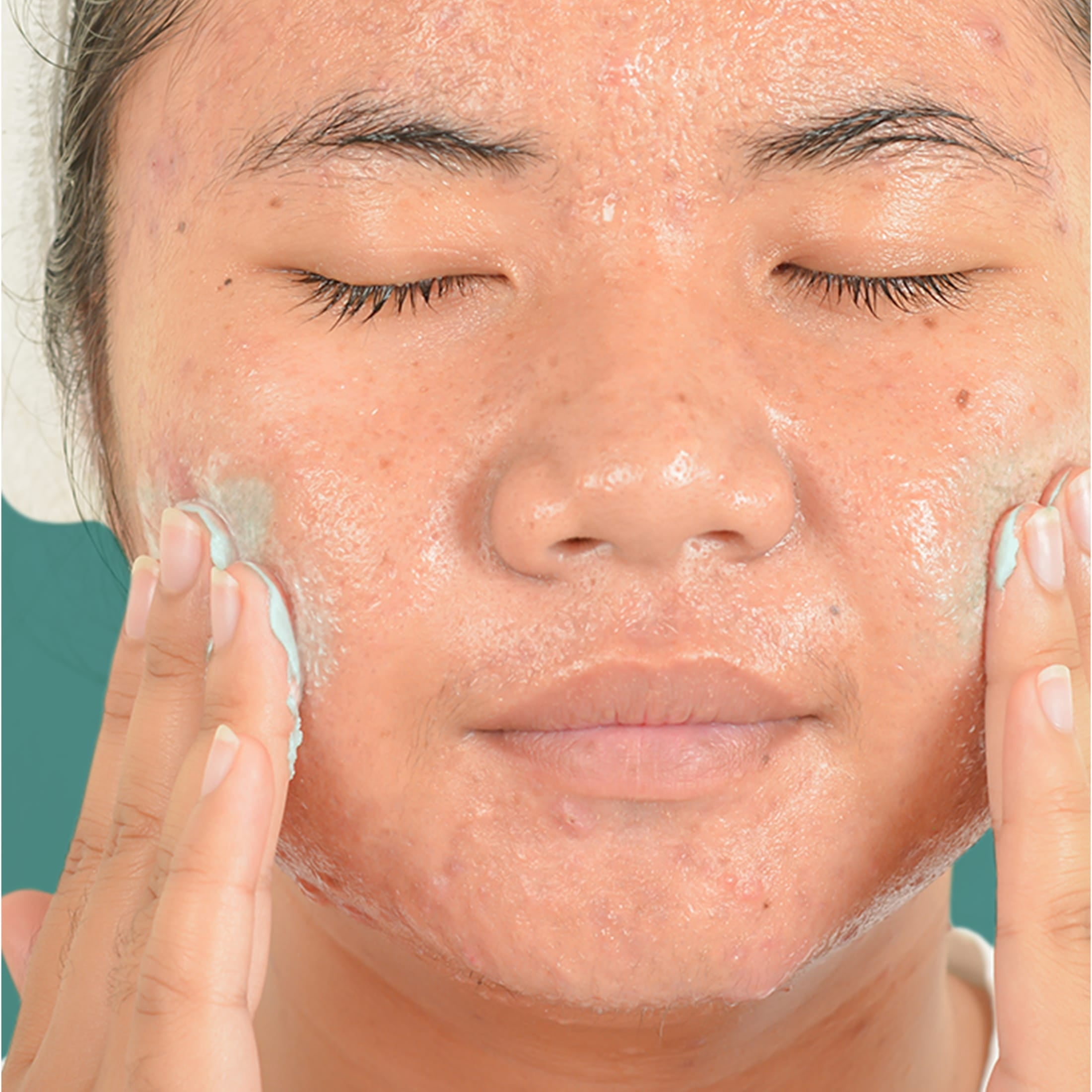 Neutrogena Oil-Free Acne Face Wash, Exfoliating Face Scrub & Treatment, 4.2 fl oz