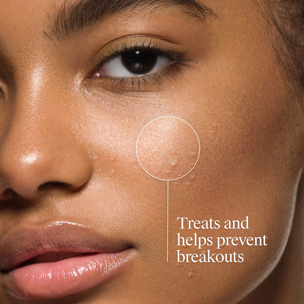 Neutrogena Oil-Free Acne Face Wash, Fragrance Free, 2% Salicylic Acid, 9.1 fl oz