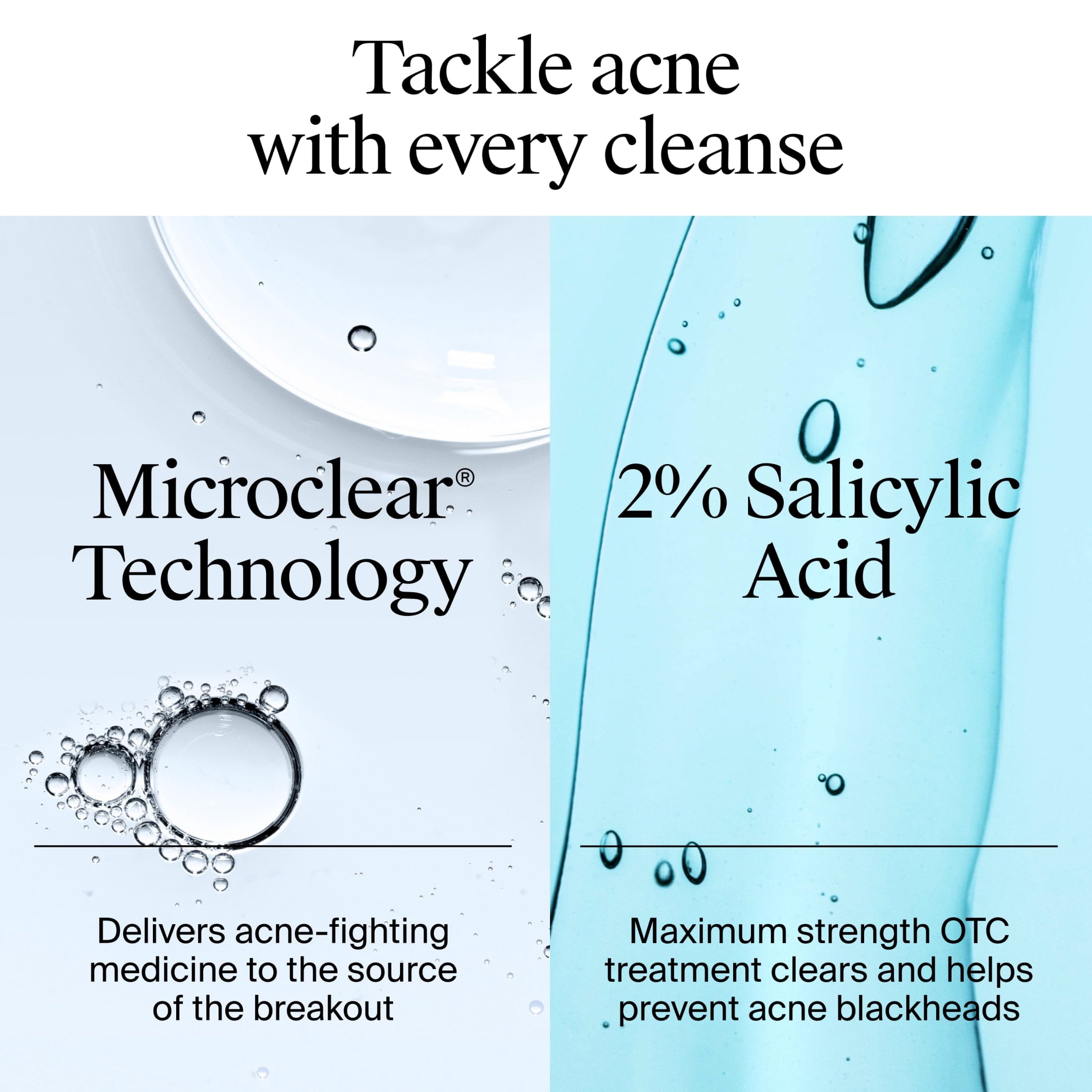 Neutrogena Oil-Free Acne Face Wash, Salicylic Acid Facial Cleanser & Acne Treatment, 6 fl oz