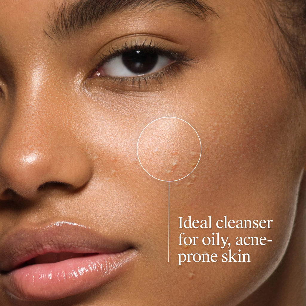 Neutrogena Oil-Free Acne Face Wash, Salicylic Acid Facial Cleanser & Acne Treatment, 6 fl oz